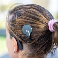 O que é e como funciona o implante coclear.